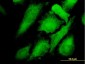 MAPK12 Antibody (monoclonal) (M06)